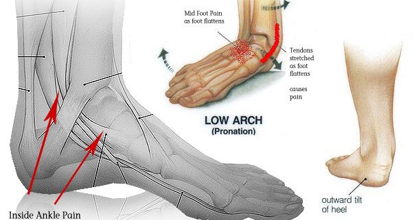 heel and inner ankle pain