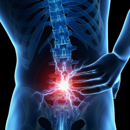 Low Back Pain Clinical Perspectives - Saanich Physio + Sports Clinic